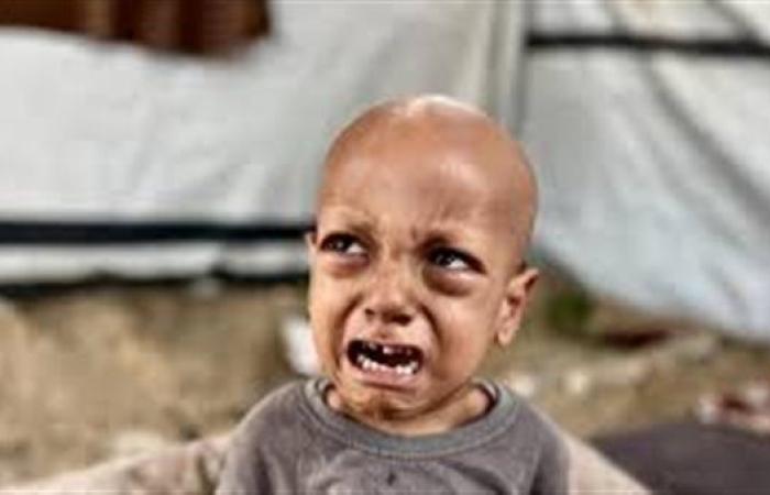 وفاة الطفل الفلسطيني صاحب عبارة "أنا جعان"