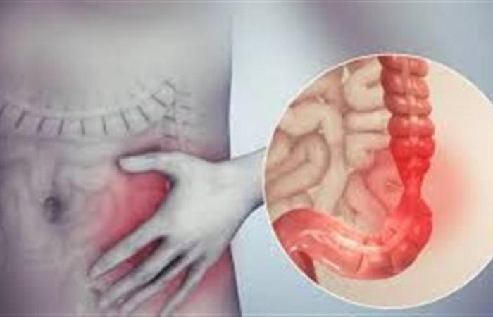 أفضل علاج للقولون العصبي.. مشروبات تخلصك من الألم سريعًا