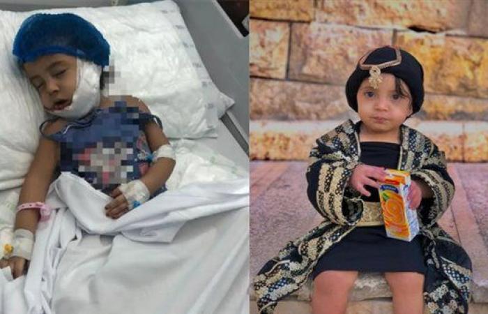 والد الطفلة حنان ضحية عقر كلب في الجمالية يستغيث: "حياة بنتي في خطر"