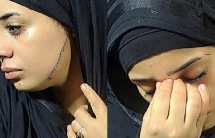 من حلم الزفاف إلى كابوس الانتقام.. تفاصيل جديدة في قضية «عروس مصر القديمة»