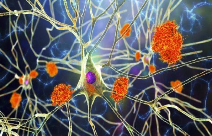 دراسة حديثة: بروتين دماغي قد يكشف ألزهايمر مبكراً ويساعد على إبطاء تقدمه