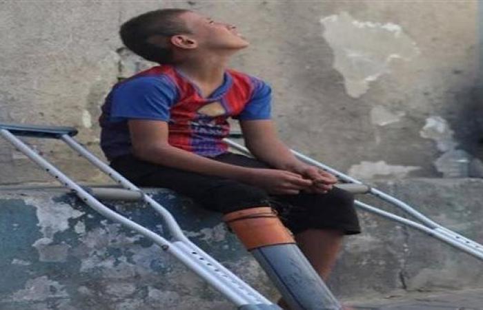 «وجع وأمل».. حكاية طفل فلسطيني حوّل أنبوبًا بلاستيكيًا إلى ساق بديلة| فيديو