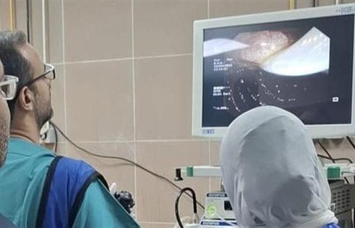 مستشفى أحمد ماهر التعليمي ينجح في استئصال ورم بالقنوات المرارية دون تدخل جراحي